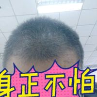 發(fā)際線用戶圖片