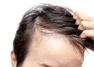 头发稀疏是什么原导致的？一下几点你中了几个