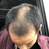 發(fā)際線用戶圖片