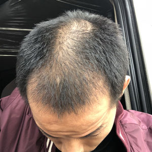 发际线分享社区