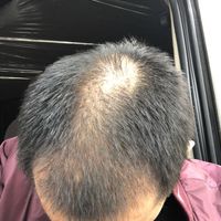 發(fā)際線用戶圖片