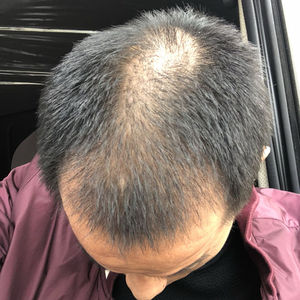 发际线分享社区