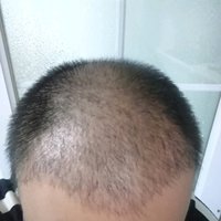 發(fā)際線用戶圖片
