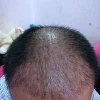 發(fā)際線用戶圖片