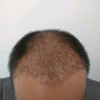 發(fā)際線用戶圖片