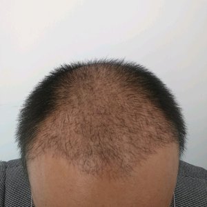 发际线分享社区