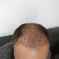 發(fā)際線用戶圖片