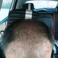 發(fā)際線用戶圖片