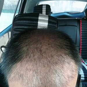 发际线分享社区
