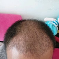 發(fā)際線用戶圖片