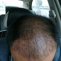 發(fā)際線用戶圖片