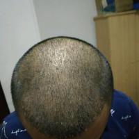 發(fā)際線用戶圖片