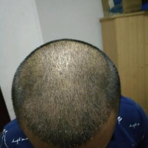 发际线分享社区