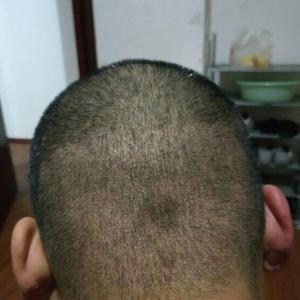 发际线分享社区