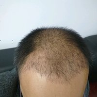 生發(fā)養(yǎng)護(hù)用戶圖片