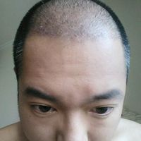 發(fā)際線用戶圖片