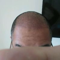 發(fā)際線用戶圖片