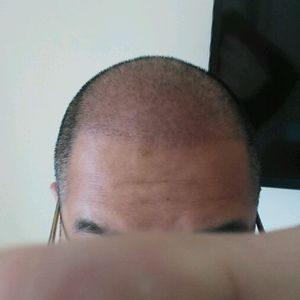 发际线分享社区