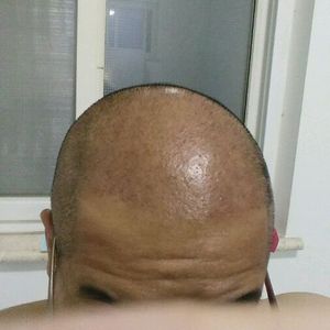 发际线分享社区