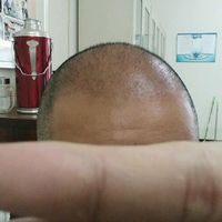 發(fā)際線用戶圖片