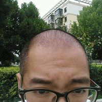 發(fā)際線用戶圖片