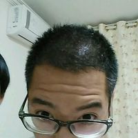 發(fā)際線用戶圖片