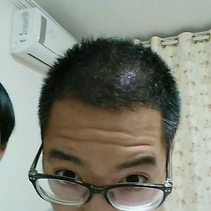 发际线分享社区