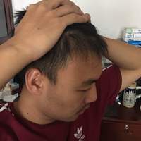 發(fā)際線用戶圖片