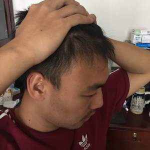 发际线分享社区