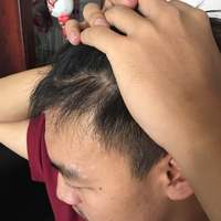 發(fā)際線用戶圖片