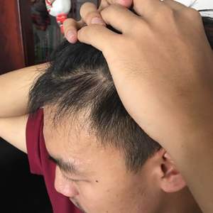发际线分享社区