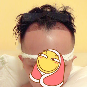 发际线分享社区