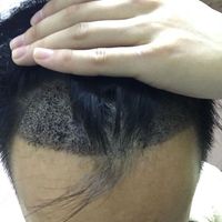發(fā)際線用戶圖片