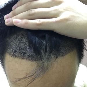 发际线分享社区