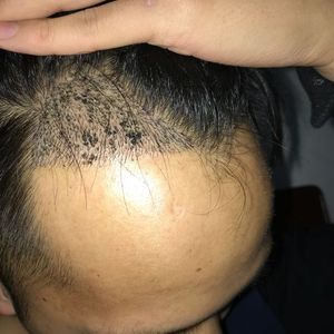 发际线分享社区