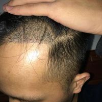 發(fā)際線用戶圖片