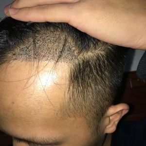 发际线分享社区