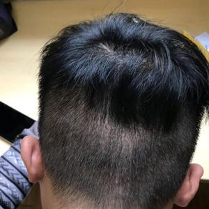 发际线分享社区