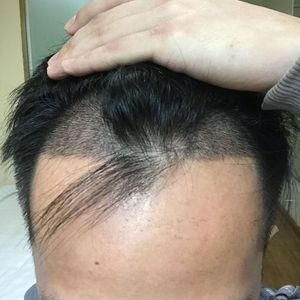 发际线分享社区
