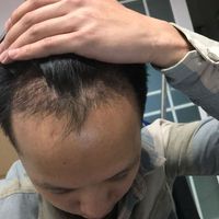 發(fā)際線用戶圖片