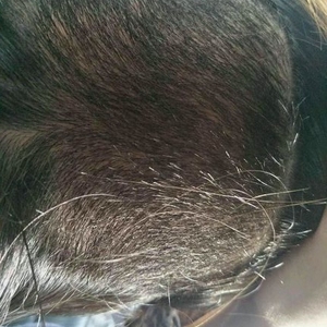发际线分享社区