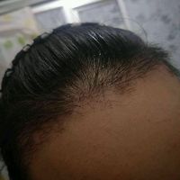 發(fā)際線用戶圖片