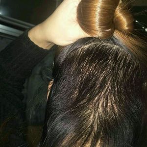 发际线分享社区