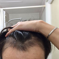 發(fā)際線用戶圖片