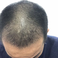 發(fā)際線用戶圖片
