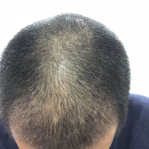 发际线分享社区