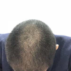 发际线分享社区