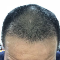 發(fā)際線用戶圖片