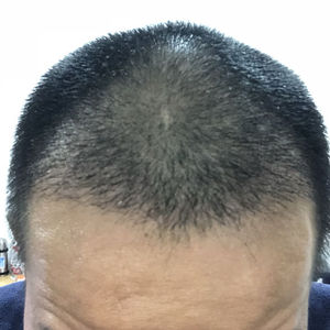 发际线分享社区
