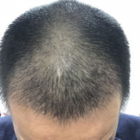 發(fā)際線用戶圖片